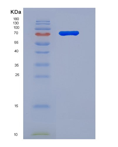 SDS-PAGE analysis of Human BRD1 (Bromodomain-Containing Protein 1) - Recombinant Protein, showing >90% purity under 15% SDS-PAGE (Reduced)