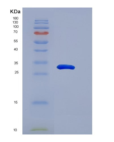 SDS-PAGE analysis of Human SNAI1 (Zinc Finger Protein Snai1) - Recombinant Protein, showing >90% purity under 15% SDS-PAGE (Reduced)