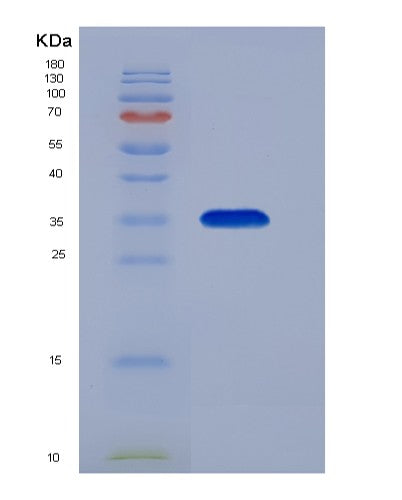 SDS-PAGE analysis of Human MBD3 (Methyl-Cpg-Binding Domain Protein 3) - Recombinant Protein, showing >85% purity under 15% SDS-PAGE (Reduced)