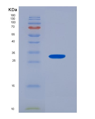 SDS-PAGE analysis of Human PAK4 (Serine/Threonine-Protein Kinase Pak 4) - Recombinant Protein, showing >95% purity under 15% SDS-PAGE (Reduced)
