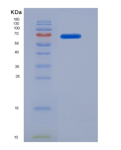 SDS-PAGE analysis of Human ADH1C (Alcohol Dehydrogenase 1C) - Recombinant Protein, showing >85% purity under 15% SDS-PAGE (Reduced)