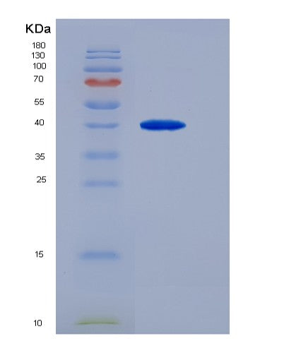 SDS-PAGE analysis of Human LDHA (L-Lactate Dehydrogenase A Chain) - Recombinant Protein, CAT# BLT-08385P showing >85% purity under 15% SDS-PAGE (Reduced)