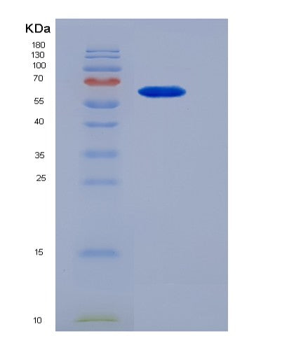 SDS-PAGE analysis of Human ALDH1A1 (Aldehyde Dehydrogenase 1A1) - Recombinant Protein, showing >90% purity under 15% SDS-PAGE (Reduced)