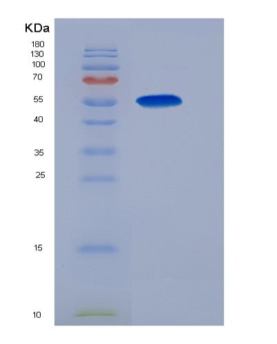 SDS-PAGE analysis of Human GSR (Glutathione Reductase, Mitochondrial) - Recombinant Protein, showing >95% purity under 15% SDS-PAGE (Reduced)