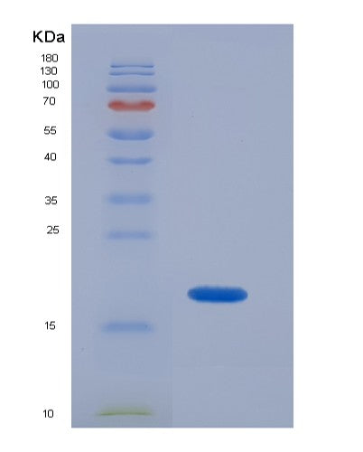 SDS-PAGE analysis of Human SOD1 (Superoxide Dismutase [Cu-Zn]) - Recombinant Protein, showing >85% purity under 15% SDS-PAGE (Reduced)