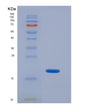 SDS-PAGE analysis of Human SOD1 (Superoxide Dismutase [Cu-Zn]) - Recombinant Protein, showing >85% purity under 15% SDS-PAGE (Reduced)