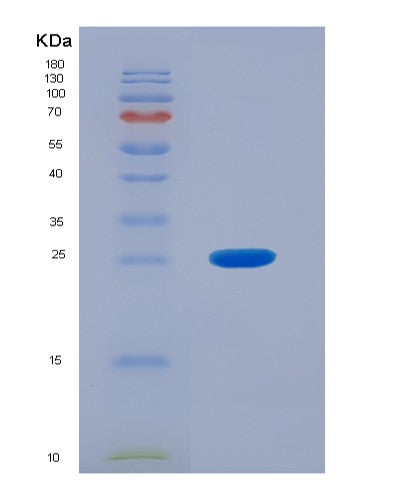 SDS-PAGE analysis of Human OTC (Ornithine Transcarbamylase, Mitochondrial) - Recombinant Protein, showing >95% purity under 15% SDS-PAGE (Reduced)