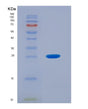 SDS-PAGE analysis of Human OTC (Ornithine Transcarbamylase, Mitochondrial) - Recombinant Protein, showing >95% purity under 15% SDS-PAGE (Reduced)