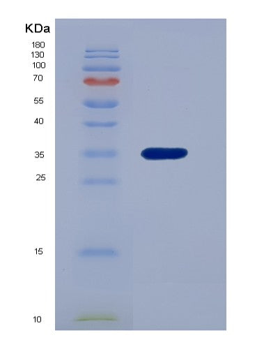 SDS-PAGE analysis of Human PNP (Purine Nucleoside Phosphorylase) - Recombinant Protein, showing >95% purity under 15% SDS-PAGE (Reduced)