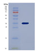 SDS-PAGE analysis of Human PNP (Purine Nucleoside Phosphorylase) - Recombinant Protein, showing >95% purity under 15% SDS-PAGE (Reduced)