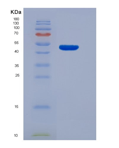 SDS-PAGE analysis of Human HPRT1 (Hypoxanthine-Guanine Phosphoribosyltransferase) - Recombinant Protein, showing >95% purity under 15% SDS-PAGE (Reduced)