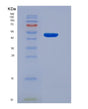 SDS-PAGE analysis of Human HPRT1 (Hypoxanthine-Guanine Phosphoribosyltransferase) - Recombinant Protein, showing >95% purity under 15% SDS-PAGE (Reduced)