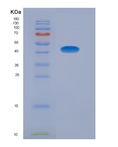 SDS-PAGE analysis of Human GOT2 (Aspartate Aminotransferase, Mitochondrial) - Recombinant Protein, showing >95% purity under 15% SDS-PAGE (Reduced)