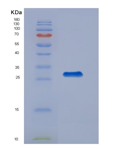 SDS-PAGE analysis of Human ABL1 (Tyrosine-Protein Kinase Abl1) - Recombinant Protein, showing >95% purity under 15% SDS-PAGE (Reduced)