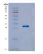 SDS-PAGE analysis of Human ABL1 (Tyrosine-Protein Kinase Abl1) - Recombinant Protein, showing >95% purity under 15% SDS-PAGE (Reduced)