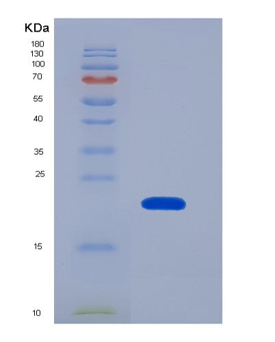 SDS-PAGE analysis of Human F2 (Prothrombin) - Recombinant Protein, showing >85% purity under 15% SDS-PAGE (Reduced)