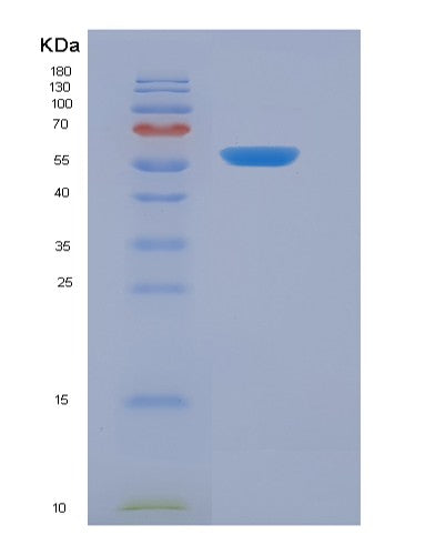 SDS-PAGE analysis of Human CFD (Complement Factor D) - Recombinant Protein, showing >85% purity under 15% SDS-PAGE (Reduced)