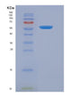 SDS-PAGE analysis of Human CFD (Complement Factor D) - Recombinant Protein, showing >85% purity under 15% SDS-PAGE (Reduced)