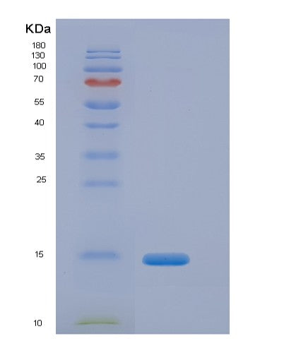 SDS-PAGE analysis of Human CFB (Complement Factor B) - Recombinant Protein, showing >90% purity under 15% SDS-PAGE (Reduced)