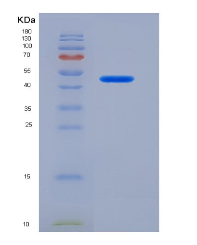 SDS-PAGE analysis of Human ASS1 (Argininosuccinate Synthase) - Recombinant Protein, showing >90% purity under 15% SDS-PAGE (Reduced)