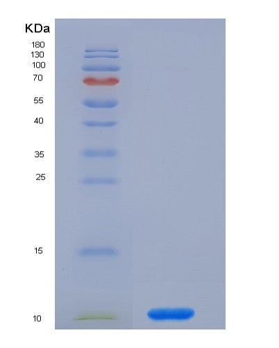 SDS-PAGE analysis of Human OAS1 (2'-5'-Oligoadenylate Synthase 1) - Recombinant Protein, showing >90% purity under 15% SDS-PAGE (Reduced)
