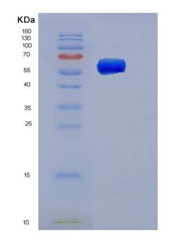 SDS-PAGE analysis of Human SERPINC1 (Antithrombin-Iii) - Recombinant Protein, showing >85% purity under 15% SDS-PAGE (Reduced)