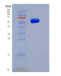 SDS-PAGE analysis of Human SERPINC1 (Antithrombin-Iii) - Recombinant Protein, showing >85% purity under 15% SDS-PAGE (Reduced)