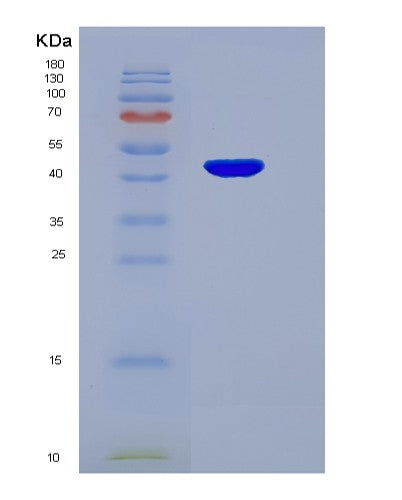SDS-PAGE analysis of Human SERPINA1 (Alpha-1-Antitrypsin) - Recombinant Protein, showing >95% purity under 15% SDS-PAGE (Reduced)