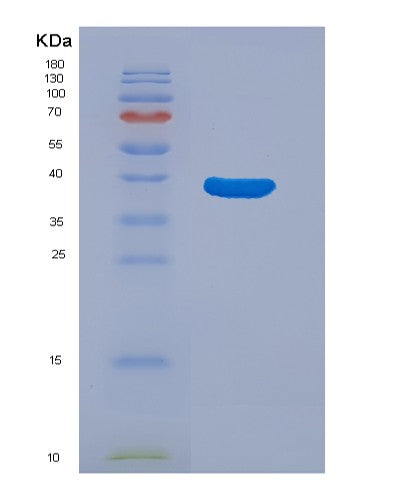 SDS-PAGE analysis of Human C3 (Complement C3) - Recombinant Protein, showing >90% purity under 15% SDS-PAGE (Reduced)