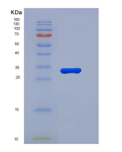 SDS-PAGE analysis of Human C5 (Complement C5) - Recombinant Protein, showing >90% purity under 15% SDS-PAGE (Reduced)