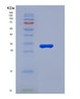 SDS-PAGE analysis of Human C5 (Complement C5) - Recombinant Protein, showing >90% purity under 15% SDS-PAGE (Reduced)