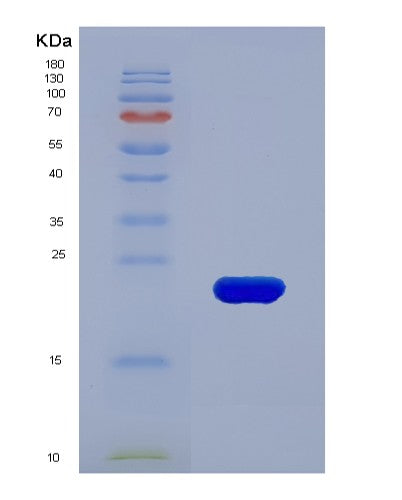 SDS-PAGE analysis of Human TIMP1 (Metalloproteinase Inhibitor 1) - Recombinant Protein, showing >90% purity under 15% SDS-PAGE (Reduced)