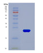 SDS-PAGE analysis of Human TIMP1 (Metalloproteinase Inhibitor 1) - Recombinant Protein, showing >90% purity under 15% SDS-PAGE (Reduced)