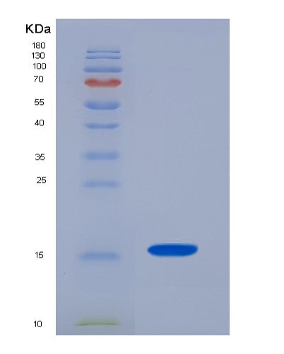 SDS-PAGE analysis of Human CST3 (Cystatin-C) - Recombinant Protein, showing >95% purity under 15% SDS-PAGE (Reduced)