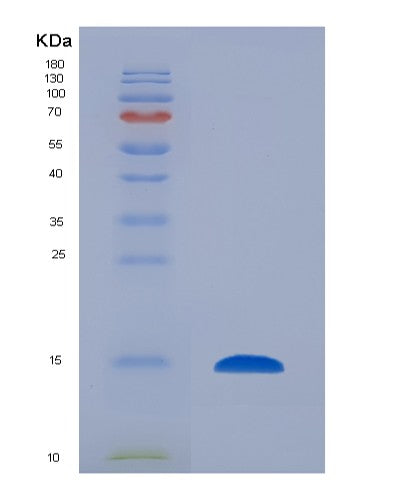 SDS-PAGE analysis of Human CST4 (Cystatin-S) - Recombinant Protein, showing >90% purity under 15% SDS-PAGE (Reduced)