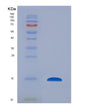 SDS-PAGE analysis of Human CST4 (Cystatin-S) - Recombinant Protein, showing >90% purity under 15% SDS-PAGE (Reduced)
