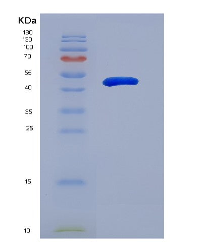 SDS-PAGE analysis of Human PRMT1 (Protein Arginine N-Methyltransferase 1) - Recombinant Protein, showing >90% purity under 15% SDS-PAGE (Reduced)