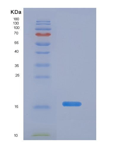 SDS-PAGE analysis of Human CSTA (Cystatin-A) - Recombinant Protein, showing >90% purity under 15% SDS-PAGE (Reduced)
