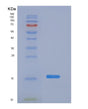 SDS-PAGE analysis of Human CSTA (Cystatin-A) - Recombinant Protein, showing >90% purity under 15% SDS-PAGE (Reduced)