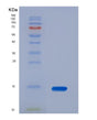 SDS-PAGE analysis of Human HRAS (Gtpase Hras) - Recombinant Protein, showing >95% purity under 15% SDS-PAGE (Reduced)