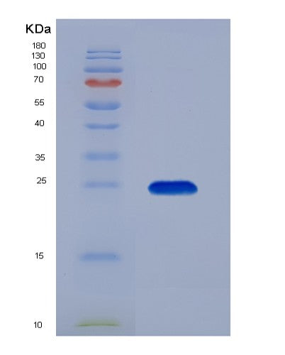 SDS-PAGE analysis of Human KRAS (Gtpase Kras) - Recombinant Protein, showing >85% purity under 15% SDS-PAGE (Reduced)