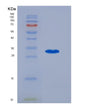 SDS-PAGE analysis of Human POMC (Pro-Opiomelanocortin) - Recombinant Protein, showing >95% purity under 15% SDS-PAGE (Reduced)