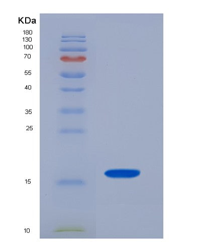 SDS-PAGE analysis of Human TSHB (Thyrotropin Subunit Beta) - Recombinant Protein, showing >85% purity under 15% SDS-PAGE (Reduced)