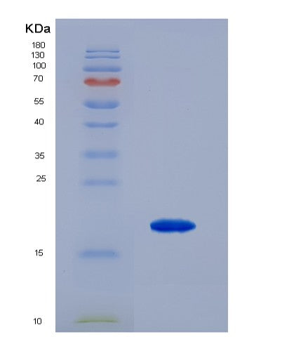 SDS-PAGE analysis of Mouse Ca5b (Carbonic Anhydrase 5B, Mitochondrial) - Recombinant Protein, showing >90% purity under 15% SDS-PAGE (Reduced)