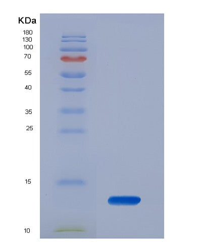 SDS-PAGE analysis of Human PTH (Parathyroid Hormone) - Recombinant Protein, showing >95% purity under 15% SDS-PAGE (Reduced)