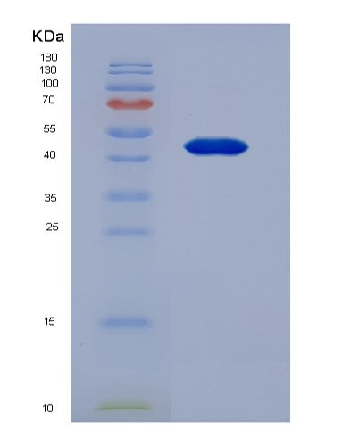 SDS-PAGE analysis of Human FGB (Fibrinogen Beta Chain) - Recombinant Protein, showing >90% purity under 15% SDS-PAGE (Reduced)