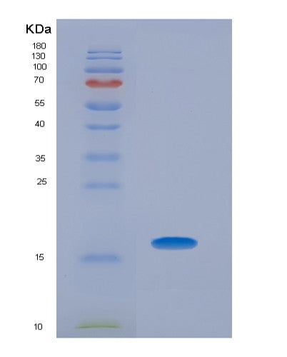 SDS-PAGE analysis of Human CRP (C-Reactive Protein) - Recombinant Protein, showing >95% purity under 15% SDS-PAGE (Reduced)