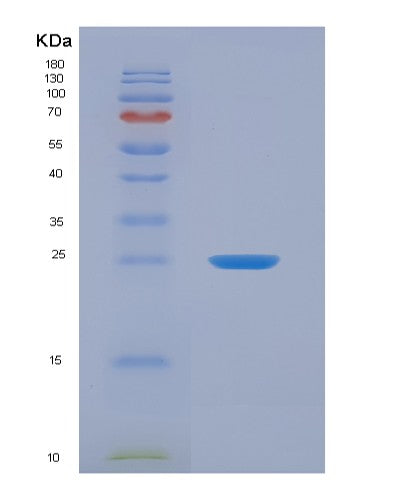 SDS-PAGE analysis of Human AMBP (Protein Ambp) - Recombinant Protein, showing >90% purity under 15% SDS-PAGE (Reduced)
