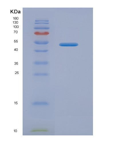SDS-PAGE analysis of Human AMBP (Protein Ambp) - Recombinant Protein, showing >90% purity under 15% SDS-PAGE (Reduced)