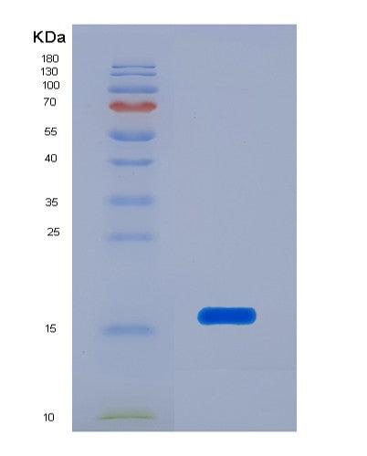 SDS-PAGE analysis of Human TTR (Transthyretin) - Recombinant Protein, showing >95% purity under 15% SDS-PAGE (Reduced)
